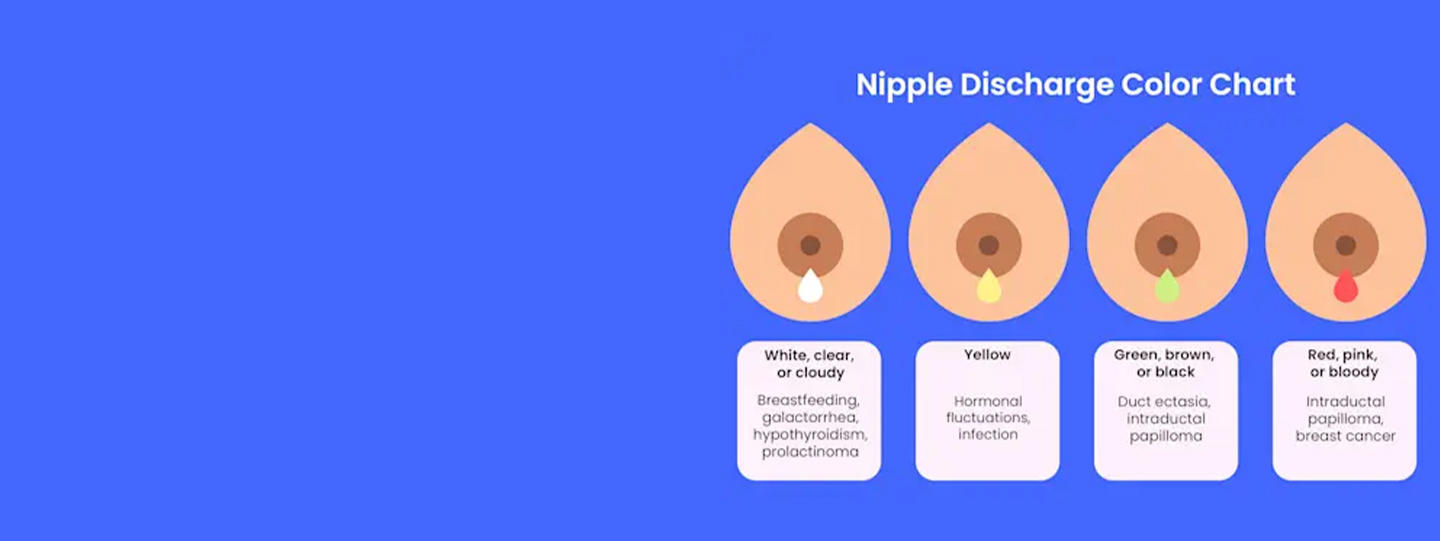 White, Green, Or Watery Nipple Discharge: What You Need To Know